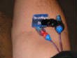 MedicalPictures/WRM25PICCdeclot.JPG
