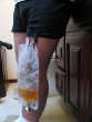 MedicalPictures/WRM7CATHIMG_3711.JPG